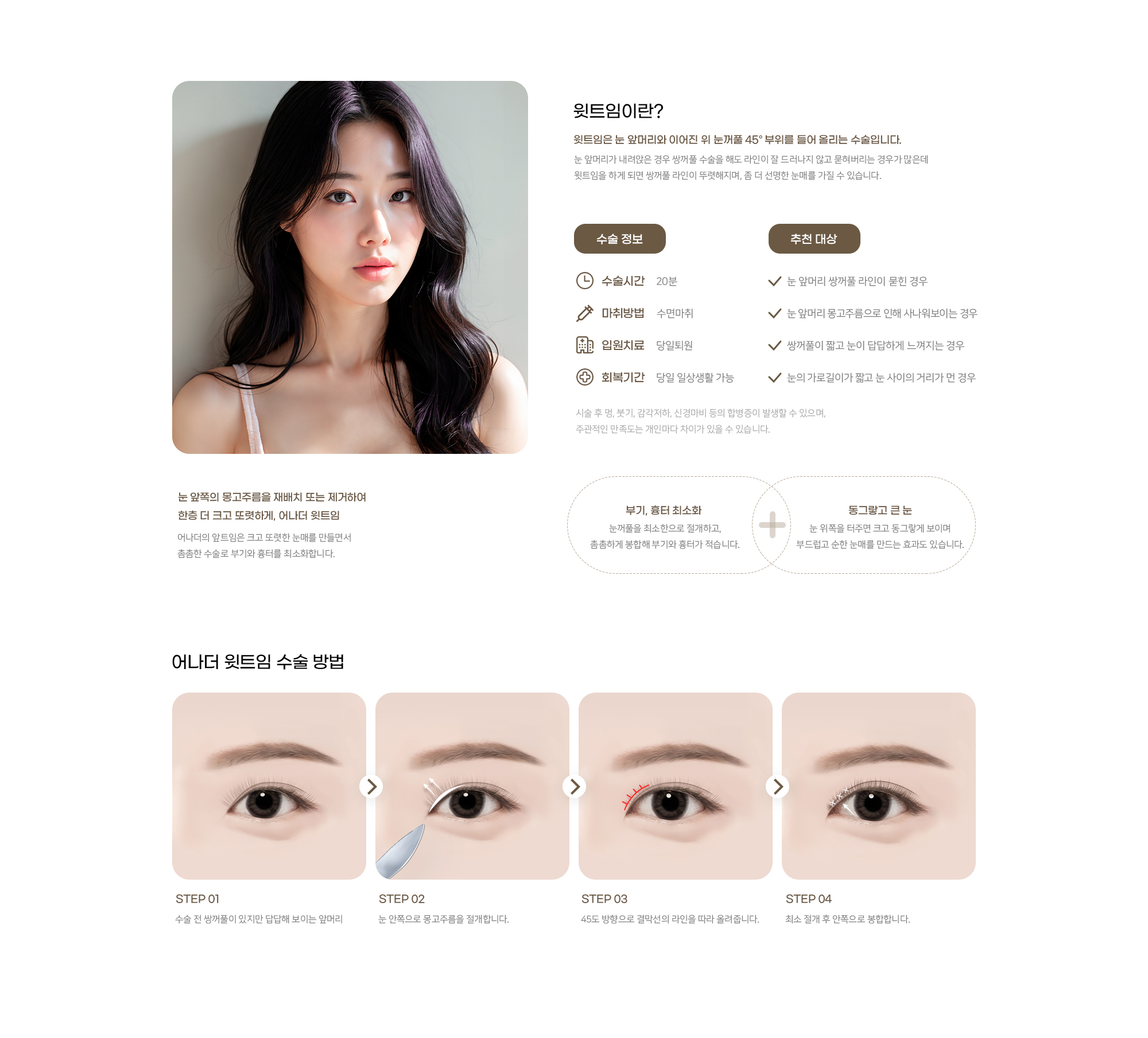어나더성형외과 윗트임